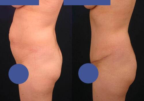 Antes/Despues
