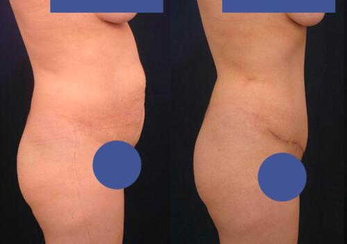 Antes/Despues